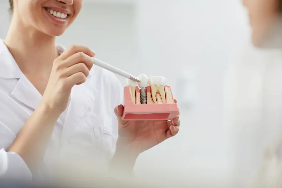 Dentista explicando o funcionamento de um implante dentário com um modelo didático.