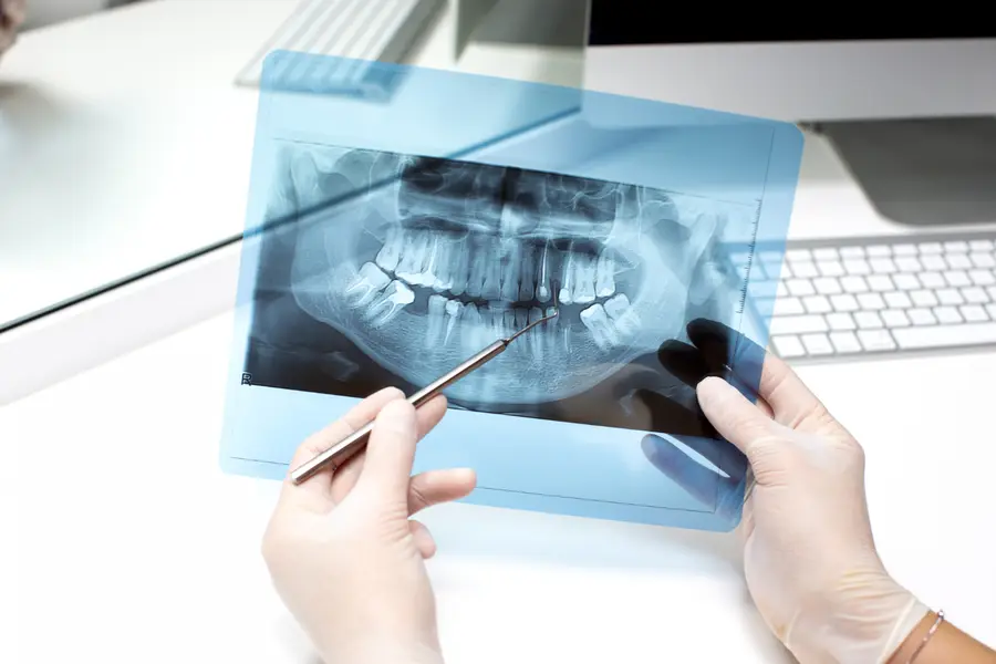 Dentista examinando uma radiografia panorâmica para avaliar um dente já tratado.